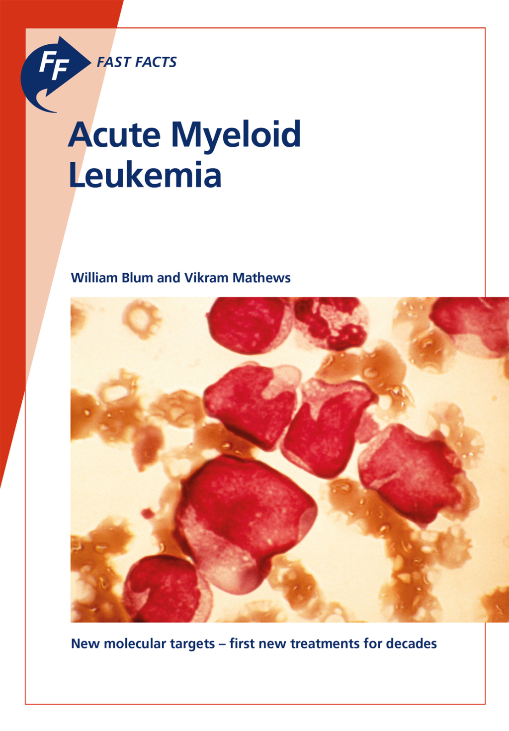 Fast Facts: Acute Myeloid Leukemia - (PDF/EPUB Version)