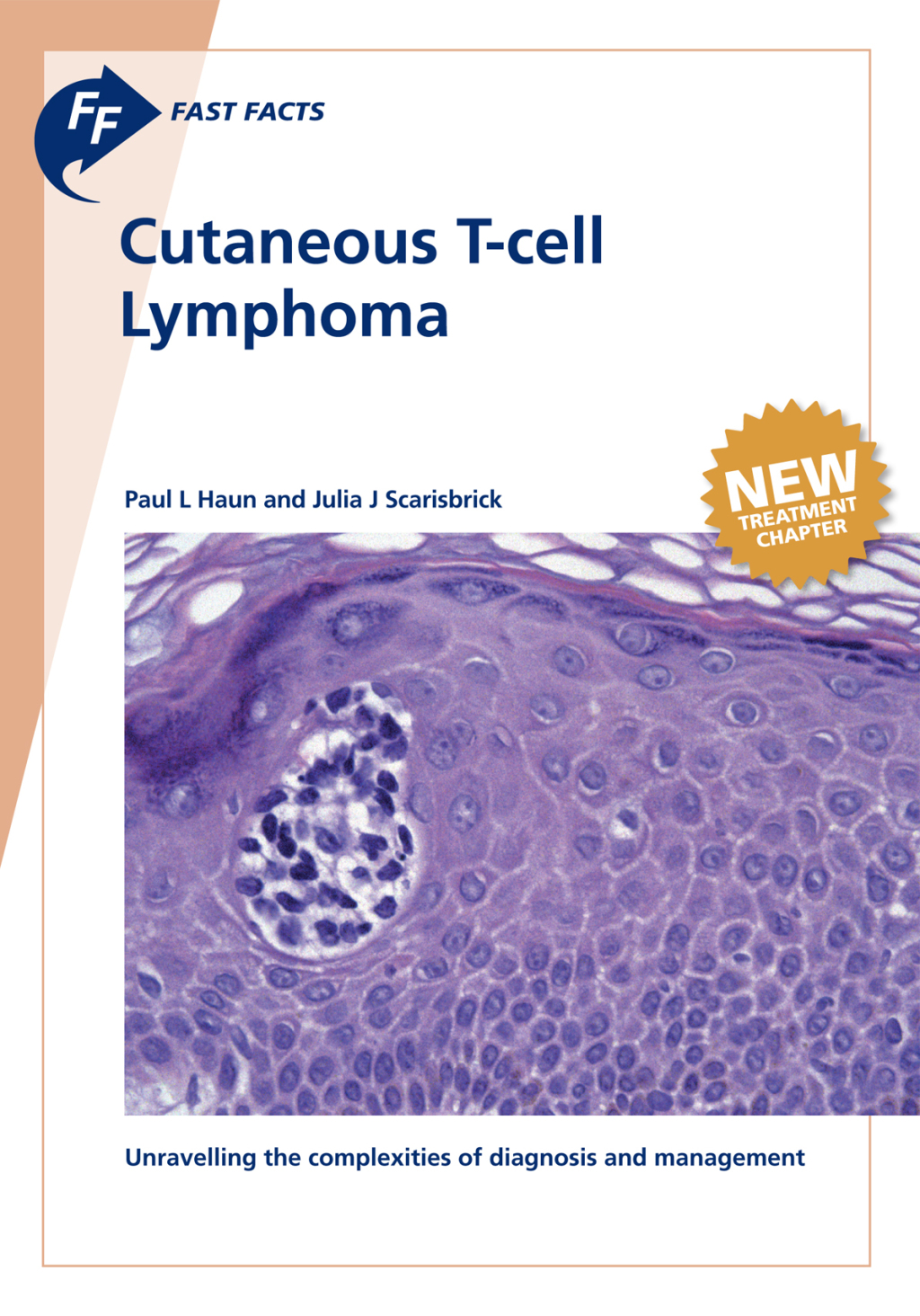 Fast Facts: Cutaneous T-cell Lymphoma - (PDF/EPUB Version)