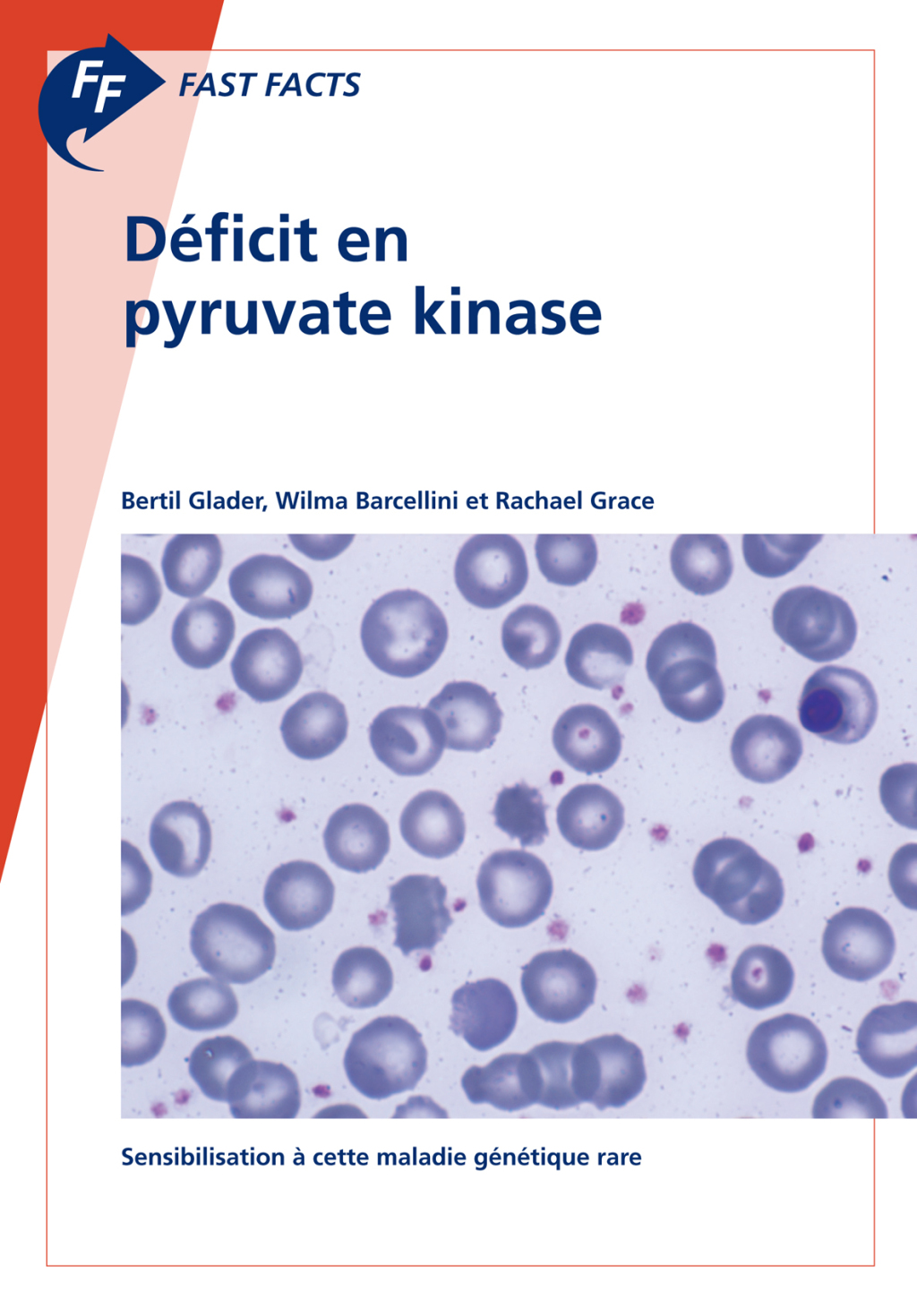 Fast Facts: DÃ©ficit en pyruvate kinase Sensibilisation Ã  cette maladie gÃ©nÃ©tique rare - (PDF/EPUB Version)
