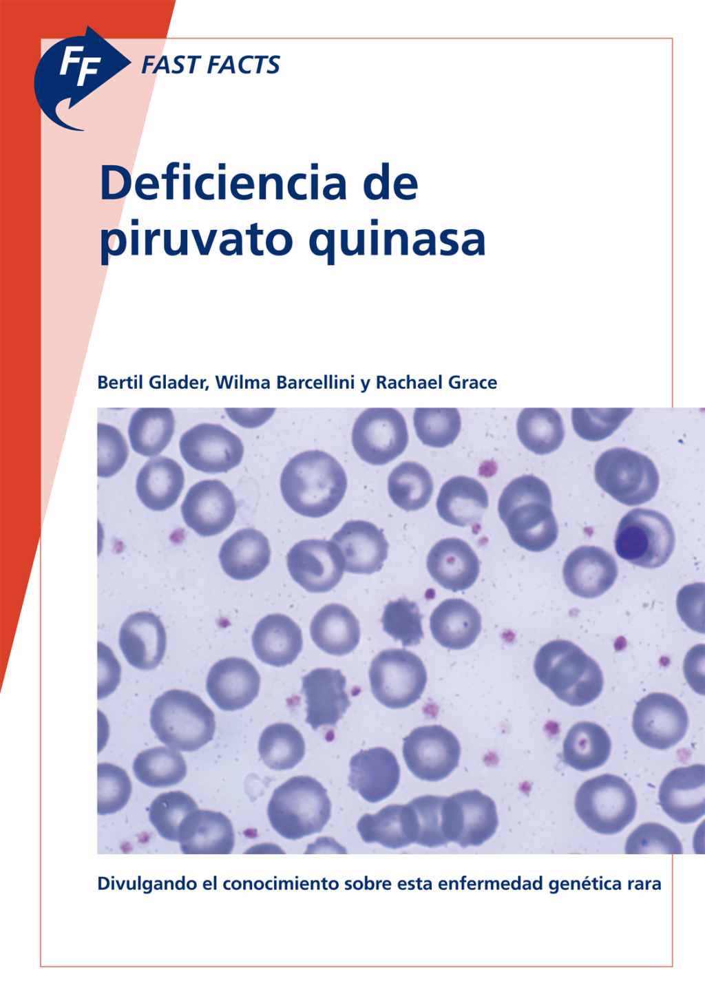 Fast Facts: Deficiencia de piruvato quinasa Divulgando el conocimiento sobre esta enfermedad genÃ©tica rara - (PDF/EPUB Version)