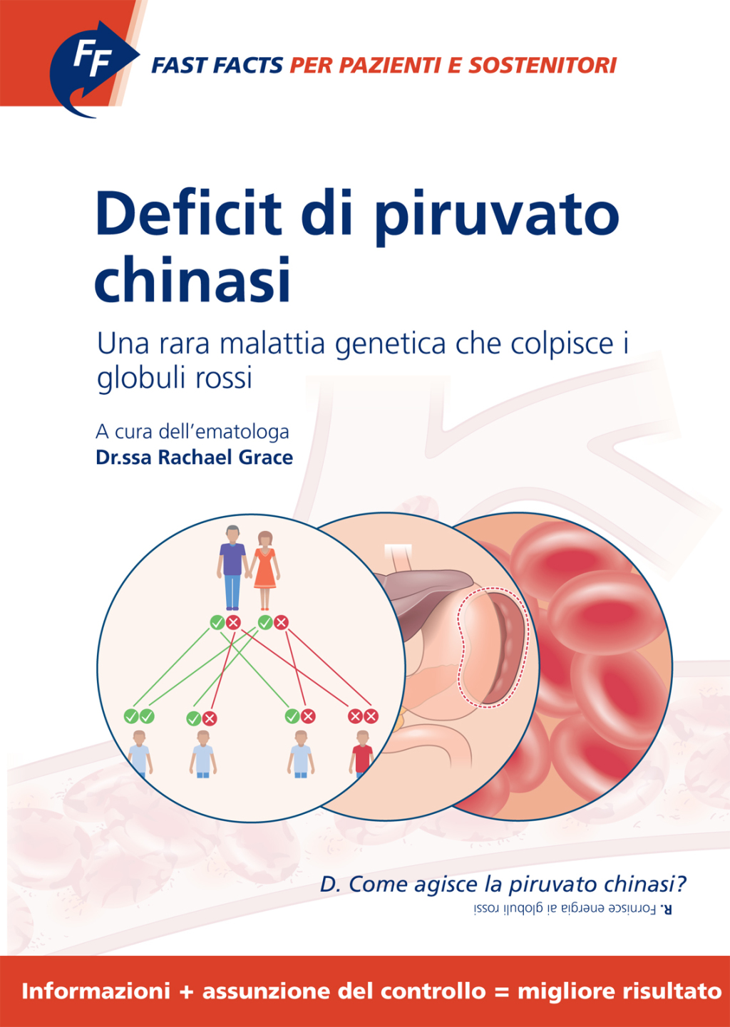 Fast Facts: Deficit di piruvato chinasi per pazienti e sostenitori Una rara malattia genetica che colpisce I globuli rossi Informazioni assunzione del controllo = migliore risultato - (PDF/EPUB Version)