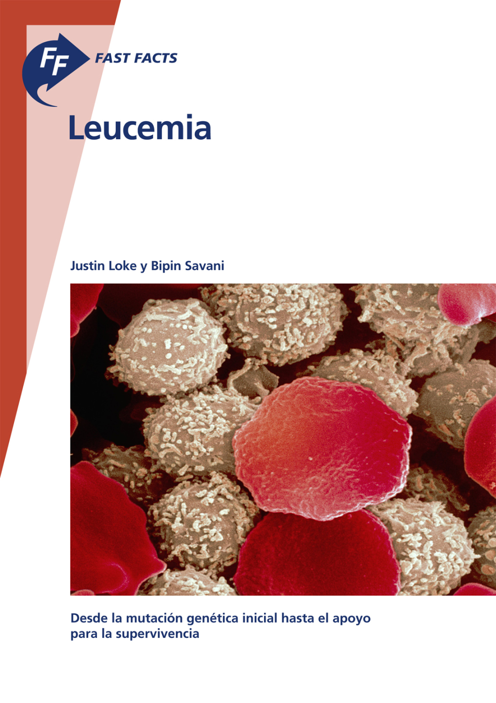 Fast Facts: Leucemia Desde la mutaciÃ³n genÃ©tica inicial hasta el apoyo para la supervivencia - (PDF/EPUB Version)