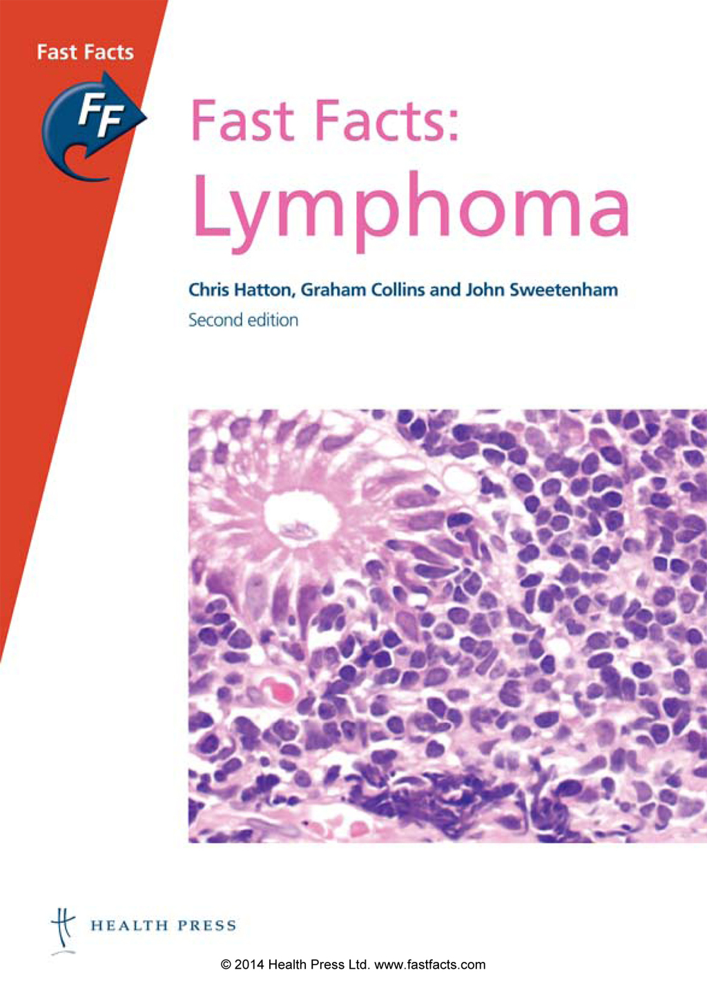 Fast Facts: Lymphoma 2nd Edition - (PDF/EPUB Version)