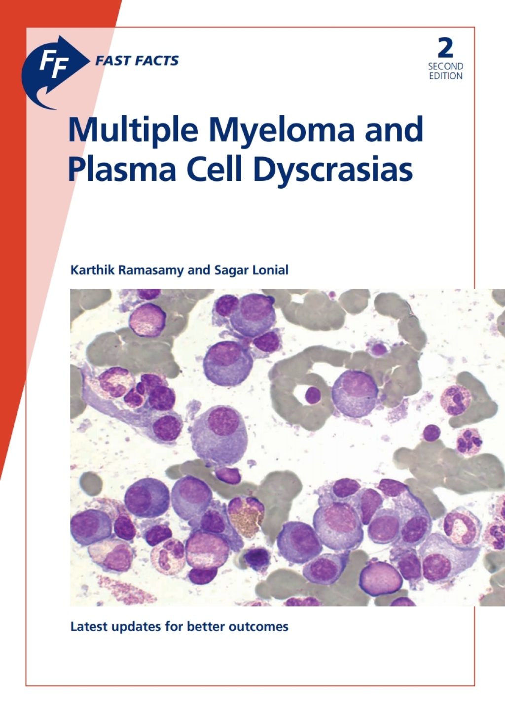 Fast Facts: Multiple Myeloma and Plasma Cell Dyscrasias 2nd Edition - (PDF/EPUB Version)