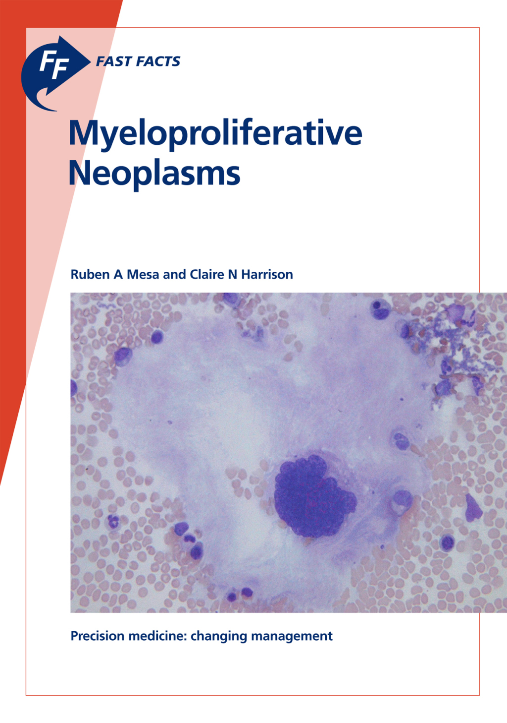 Fast Facts: Myeloproliferative Neoplasms - (PDF/EPUB Version)