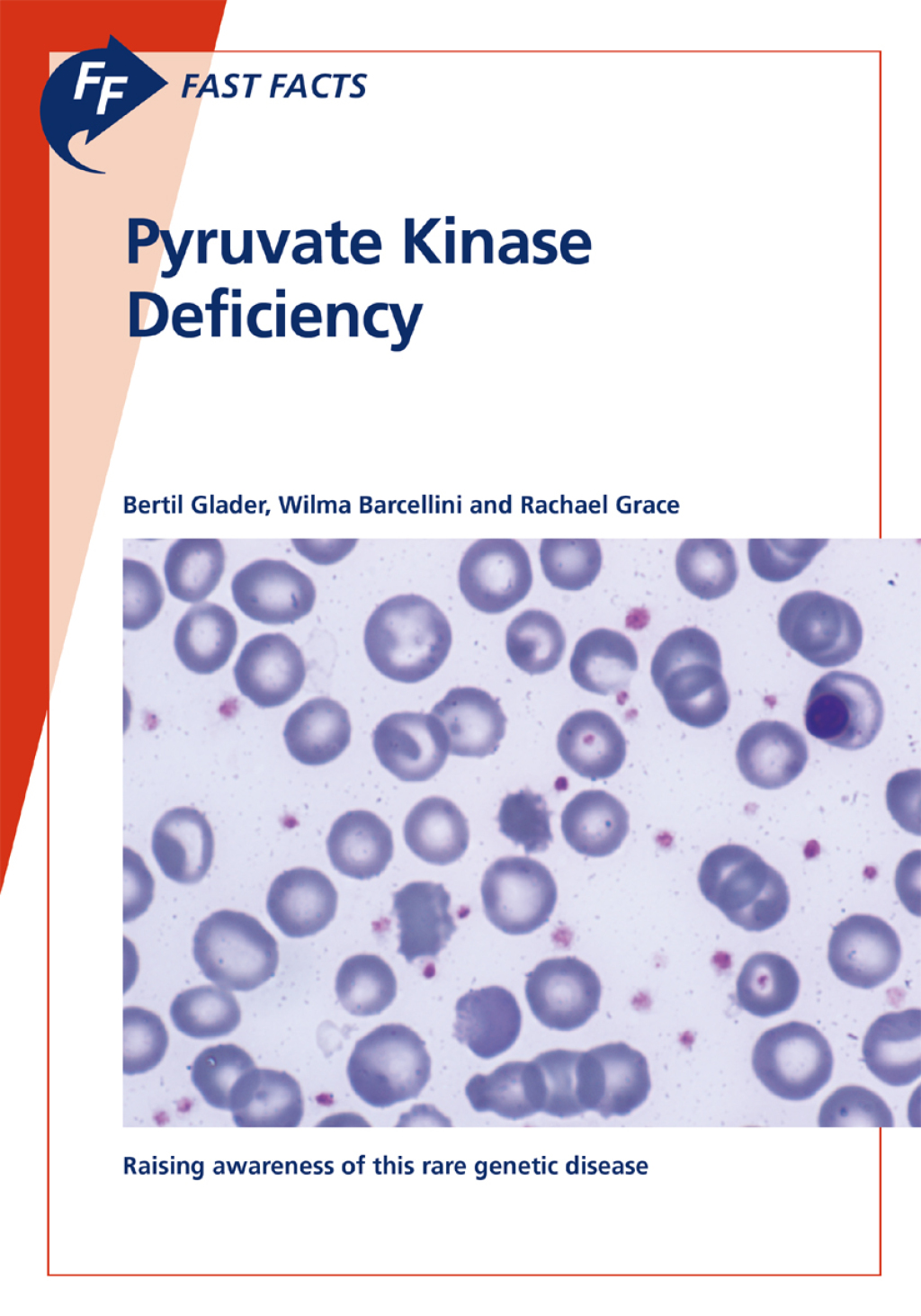 Fast Facts: Pyruvate Kinase Deficiency - (PDF/EPUB Version)