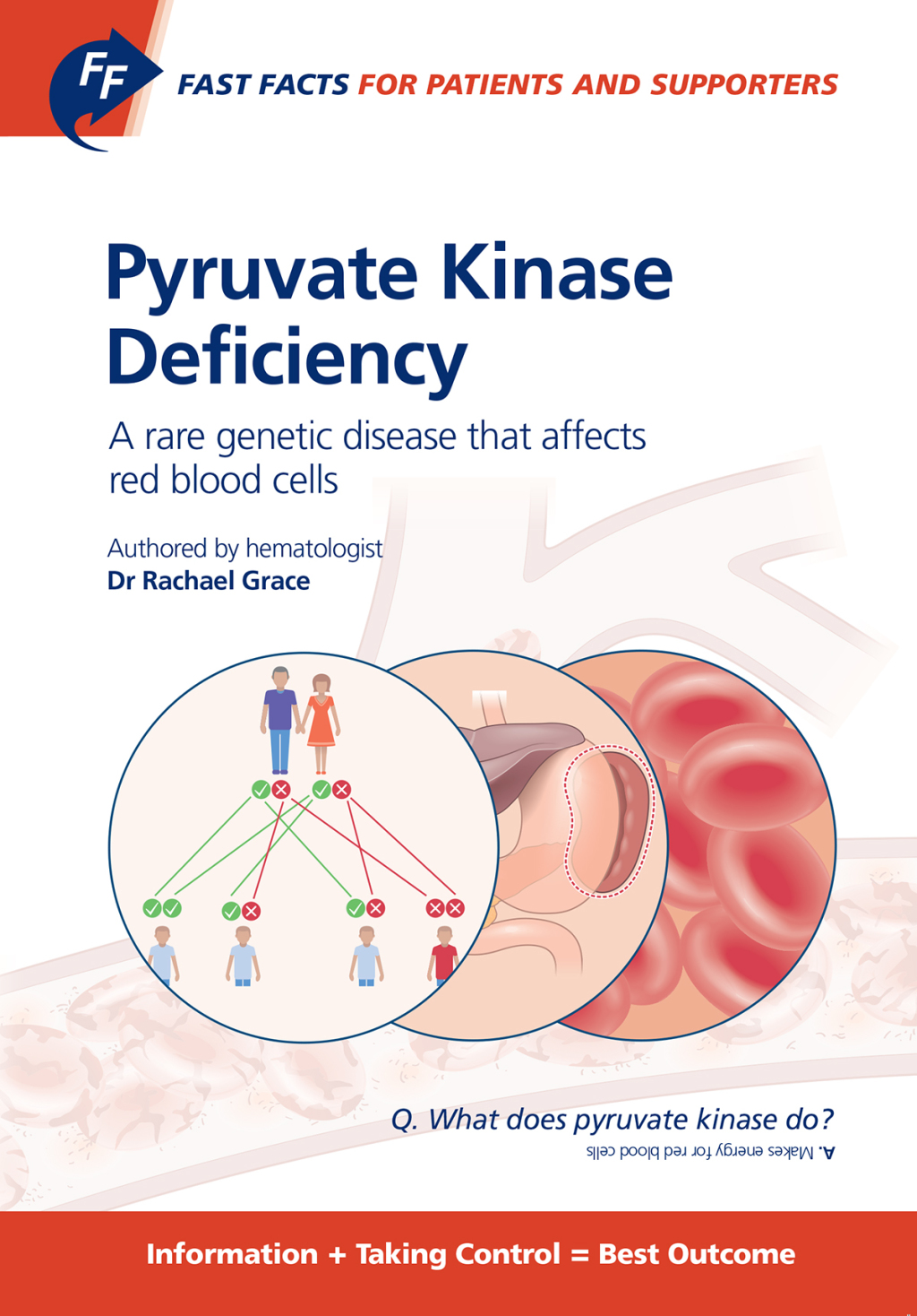 Fast Facts: Pyruvate Kinase Deficiency for Patients and Supporters A rare genetic disease that affects red blood cells - (PDF/EPUB Version)