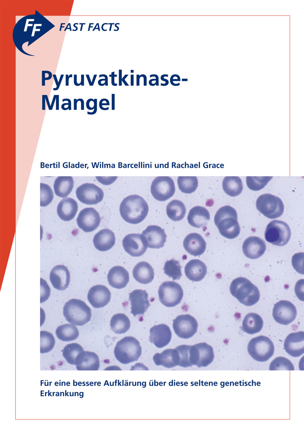 Fast Facts: Pyruvatkinase-Mangel FÃ¼r eine bessere AufklÃ¤rung Ã¼ber diese seltene genetische Erkrankung - (PDF/EPUB Version)