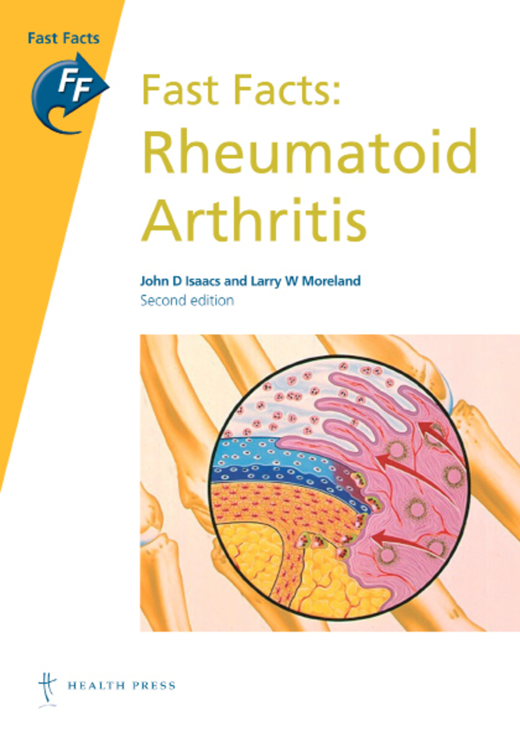 Fast Facts: Rheumatoid Arthritis 2nd Edition - (PDF/EPUB Version)