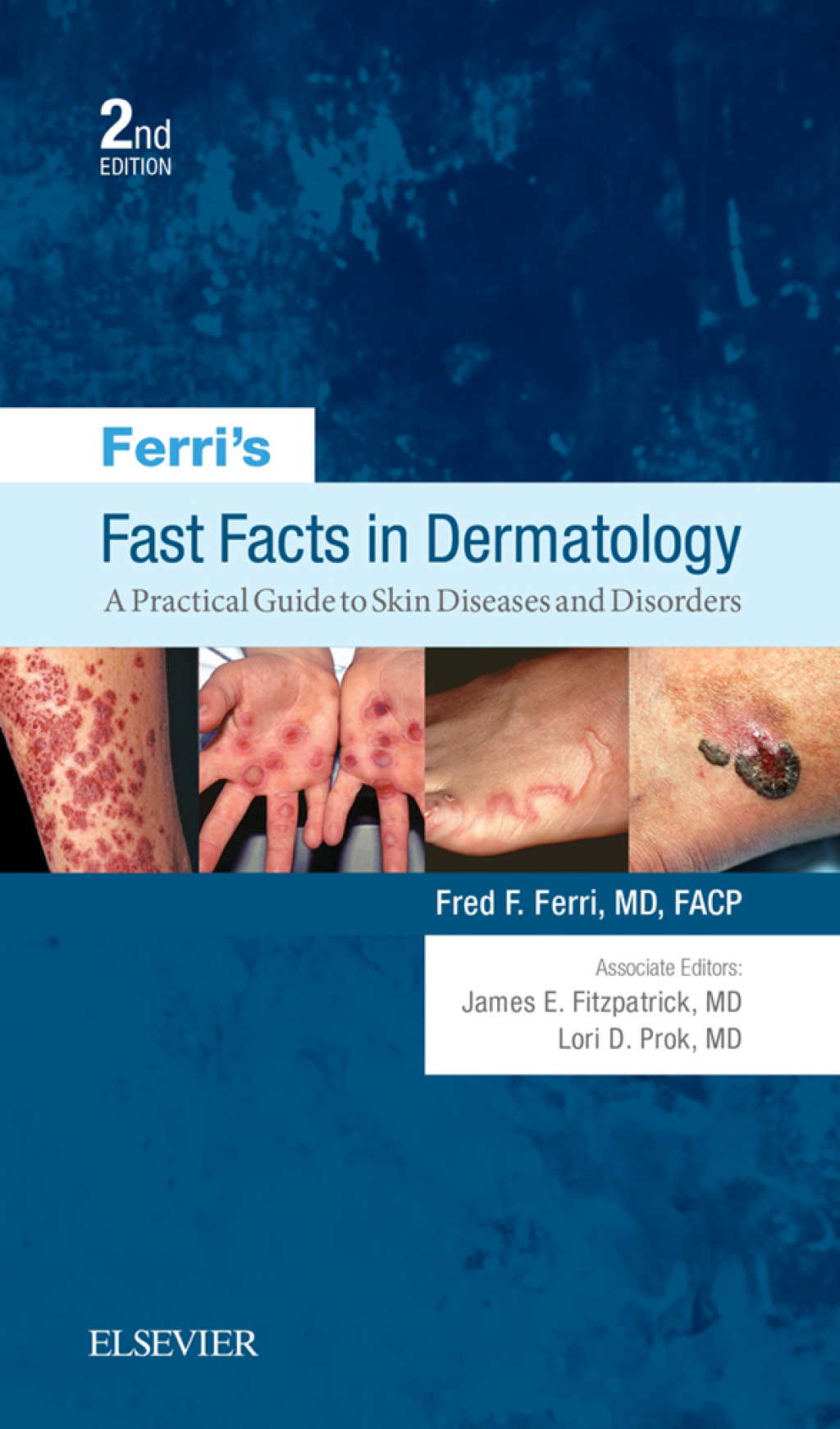 Ferri's Fast Facts in Dermatology A Practical Guide to Skin Diseases and Disorders 2nd Edition - (PDF/EPUB Version)