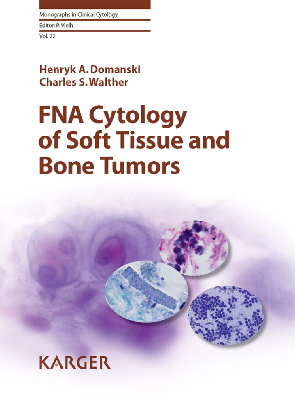 FNA Cytology of Soft Tissue and Bone Tumors 1st Edition â€“ PDF/EPUB ...