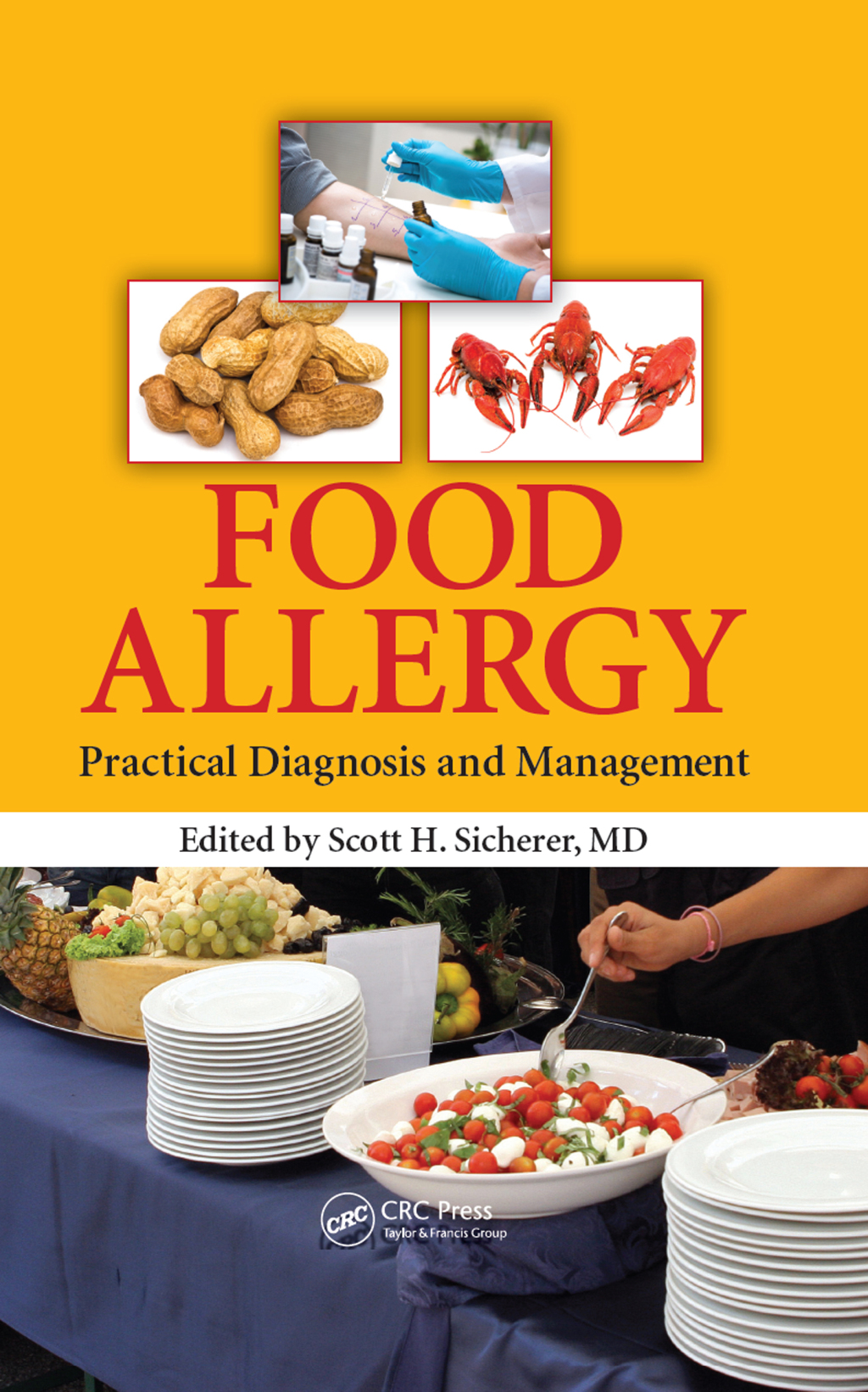 Food Allergy Practical Diagnosis and Management 1st Edition â€“ PDF ...