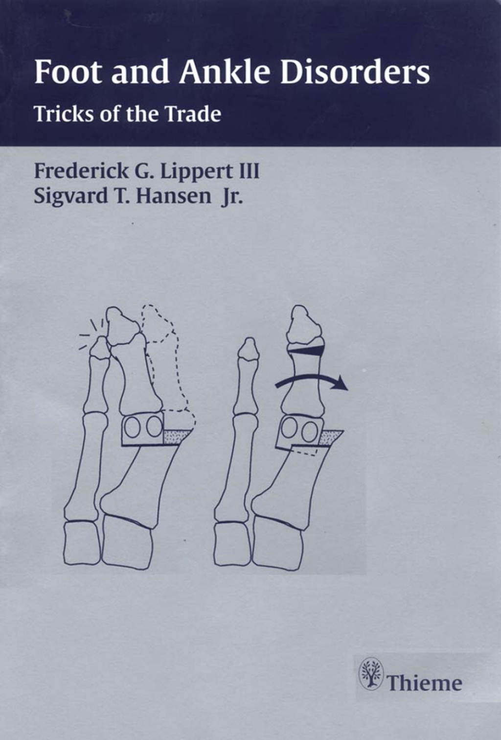 Foot and Ankle Disorders Tricks of the Trade 1st Edition â€“ PDF/EPUB ...