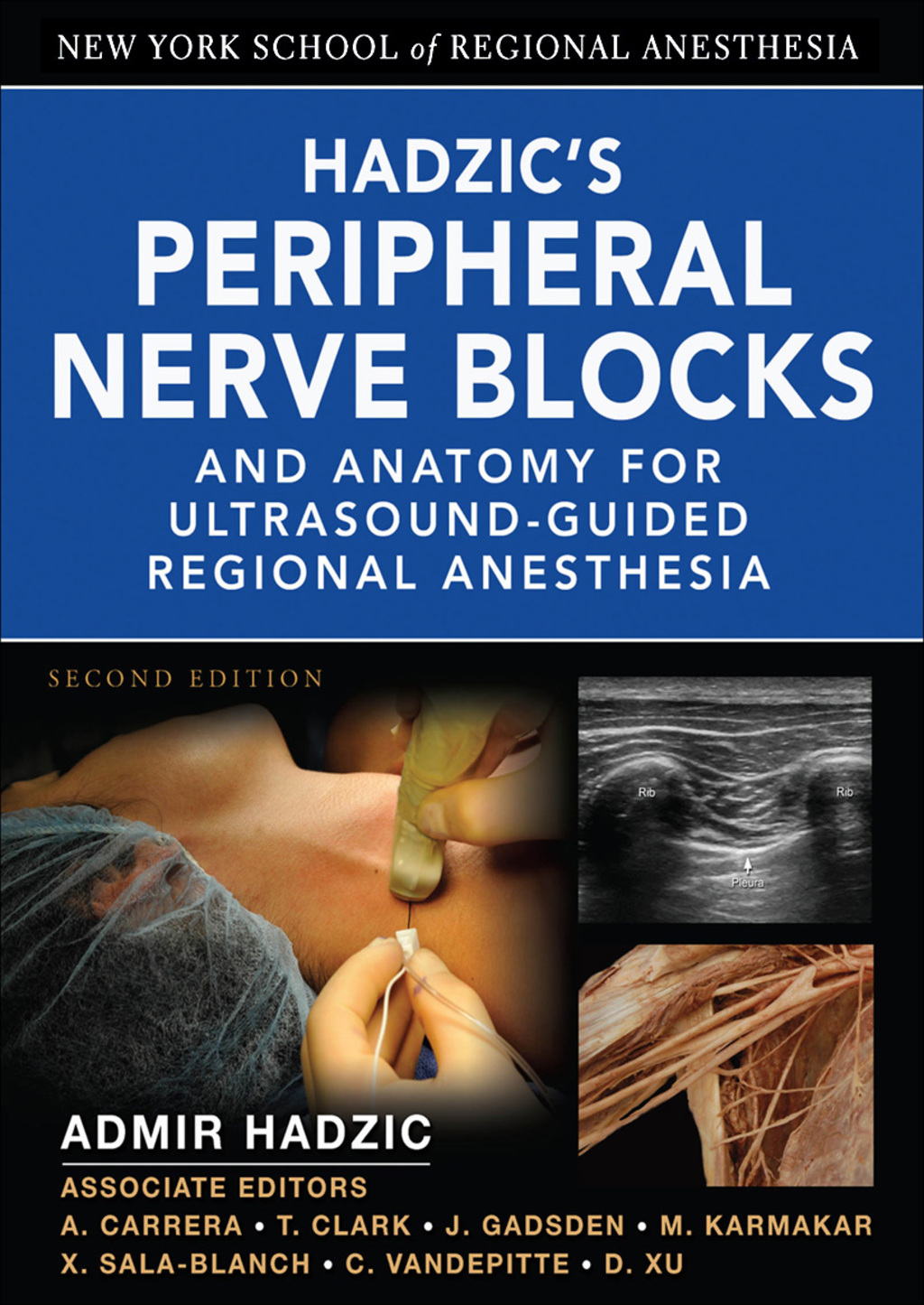 Hadzic's Peripheral Nerve Blocks and Anatomy for Ultrasound-Guided Regional Anesthesia 2nd Edition â€“ PDF/EPUB Version Downloadable