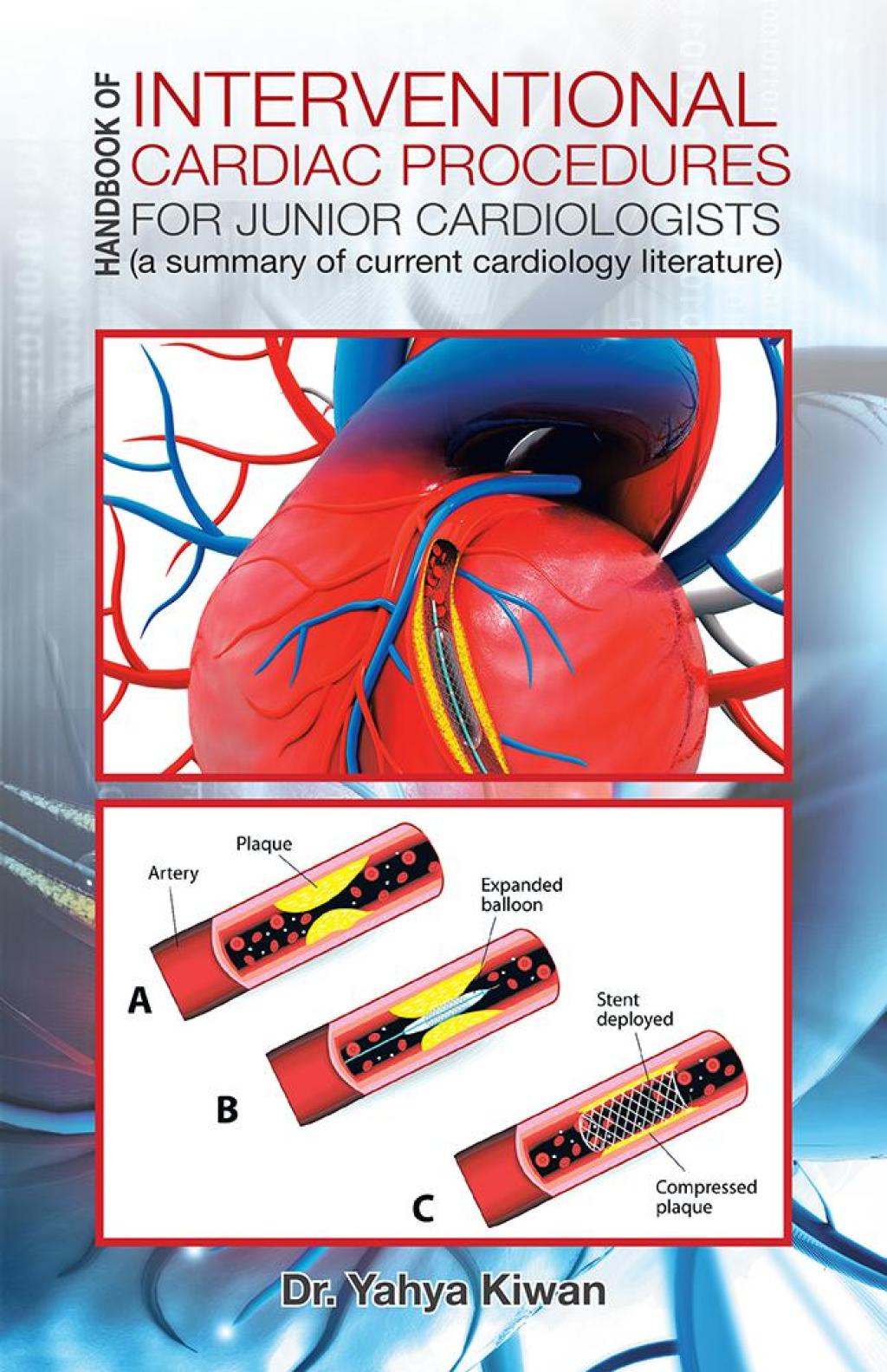 Handbook of Interventional Cardiac Procedures for Junior Cardiologists A Summary of Current Cardiology Literature - (PDF/EPUB Version)