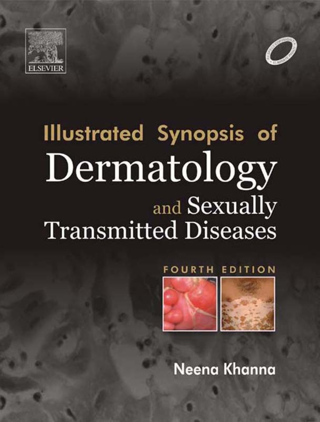 Illustrated Synopsis of Dermatology & Sexually Transmitted Diseases 4th Edition - (PDF/EPUB Version)