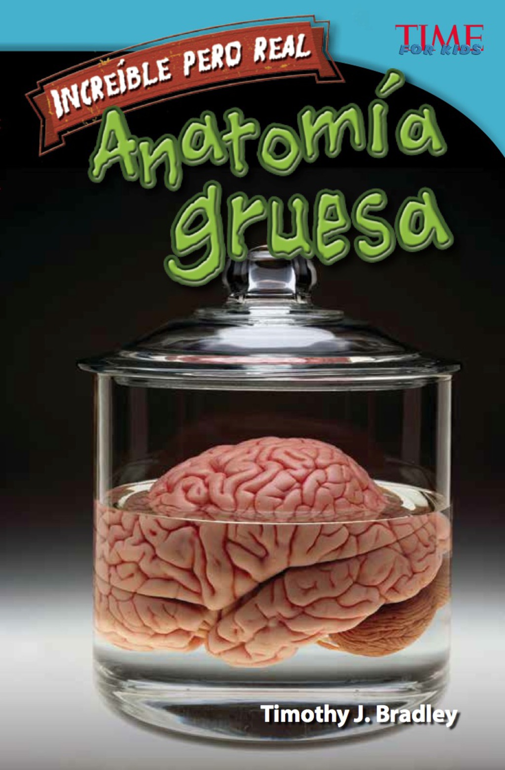 IncreÃ­ble pero real: AnatomÃ­a gruesa (Strange but True: Gross Anatomy) 2nd Edition - (PDF/EPUB Version)