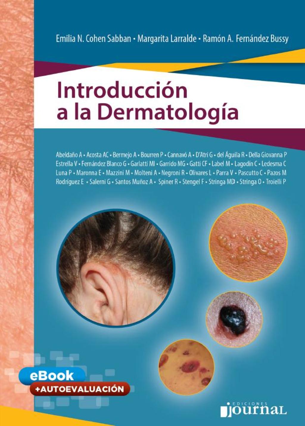 IntroducciÃ³n a la DermatologÃ­a 1st Edition - (PDF/EPUB Version)