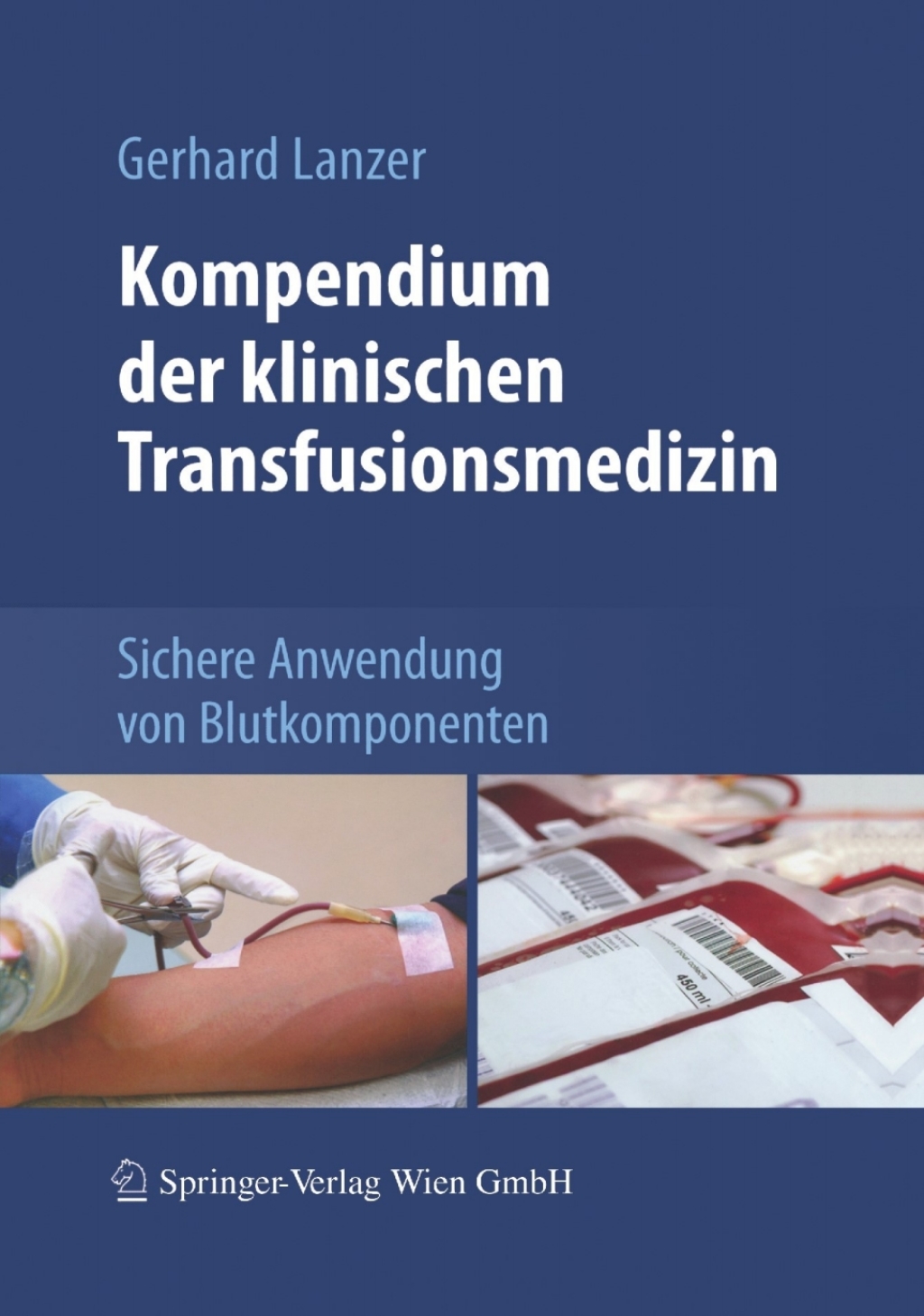 Kompendium der klinischen Transfusionsmedizin Sichere Anwendung von Blutkomponenten - (PDF/EPUB Version)