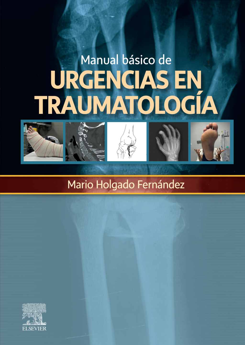 Manual bÃ¡sico de urgencias en traumatologÃ­a - (PDF/EPUB Version)