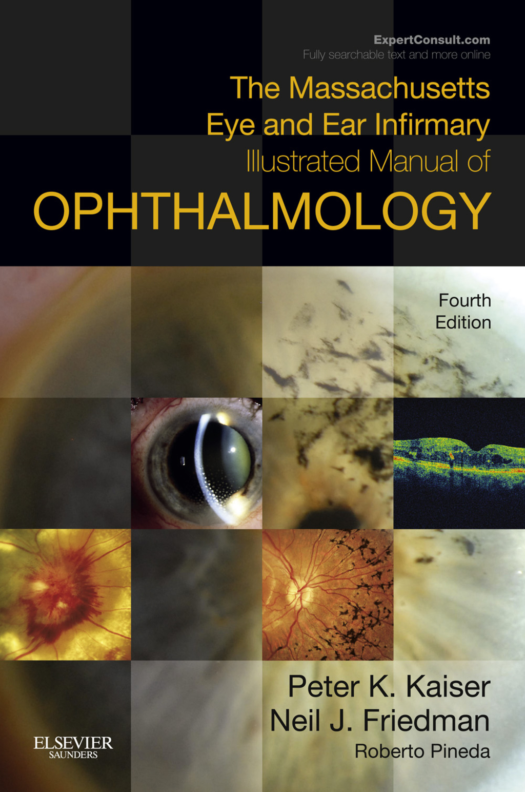 Massachusetts Eye and Ear Infirmary Illustrated Manual of Ophthalmology 4th Edition â€“ PDF/EPUB Version Downloadable