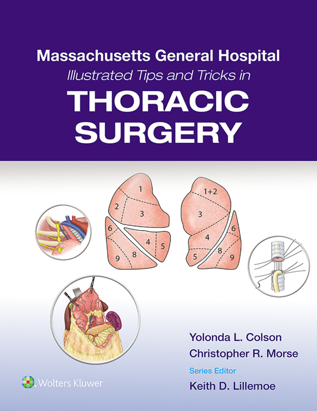 Massachusetts General Hospital Illustrated Tips and Tricks in Thoracic Surgery eBook with Multimedia 1st Edition â€“ PDF/EPUB Version Downloadable