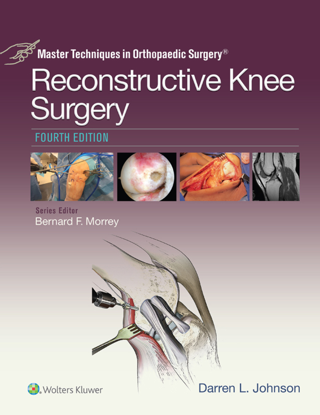 Master Techniques in Orthopaedic Surgery: Reconstructive Knee Surgery 4th Edition â€“ PDF/EPUB Version Downloadable