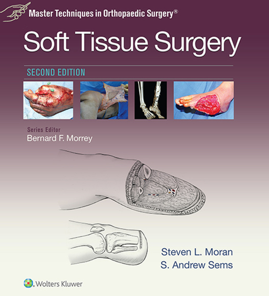 Master Techniques in Orthopaedic Surgery: Soft Tissue Surgery 2nd Edition â€“ PDF/EPUB Version Downloadable