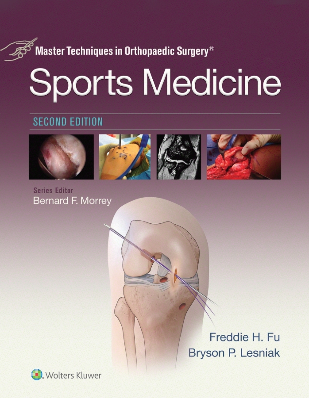 Master Techniques in Orthopaedic Surgery: Sports Medicine 2nd Edition â€“ PDF/EPUB Version Downloadable