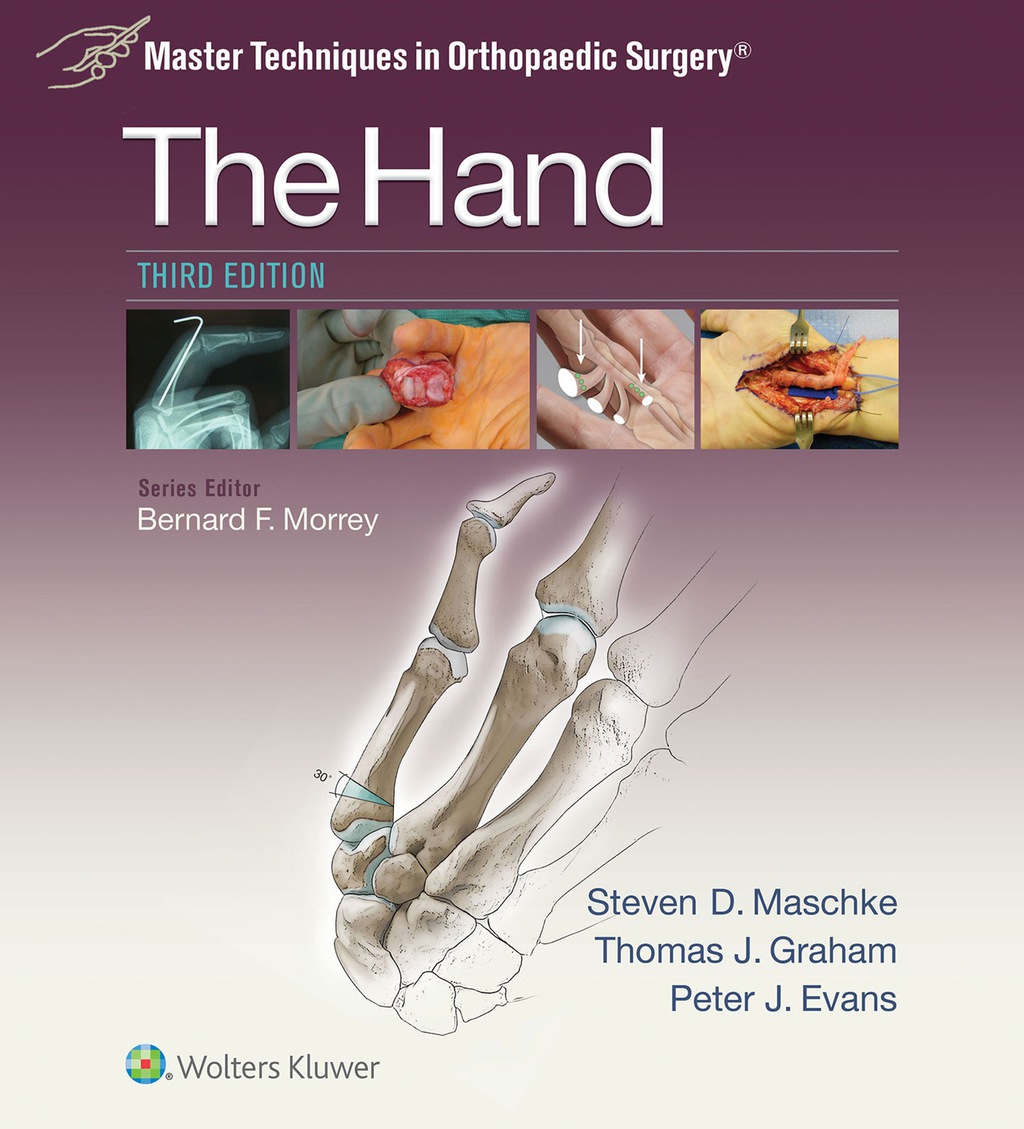Master Techniques in Orthopaedic Surgery: The Hand 3rd Edition â€“ PDF/EPUB Version Downloadable