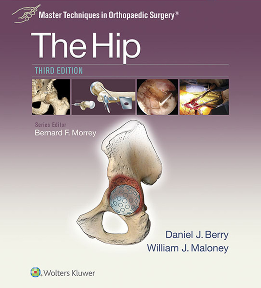 Master Techniques in Orthopaedic Surgery: The Hip 3rd Edition â€“ PDF/EPUB Version Downloadable
