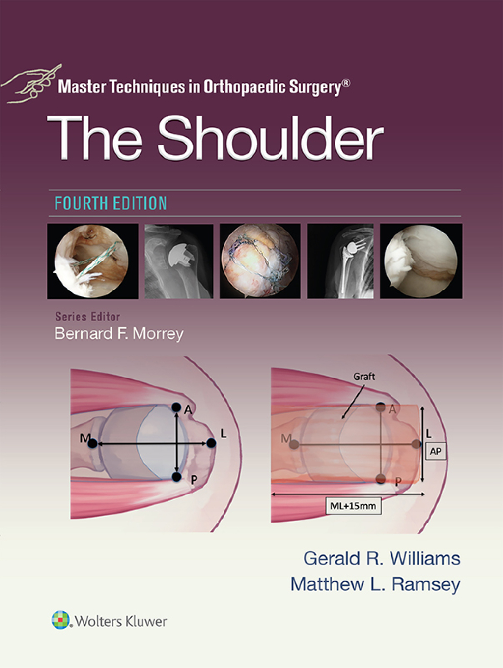 Master Techniques in Orthopaedic Surgery: The Shoulder 4th Edition â€“ PDF/EPUB Version Downloadable