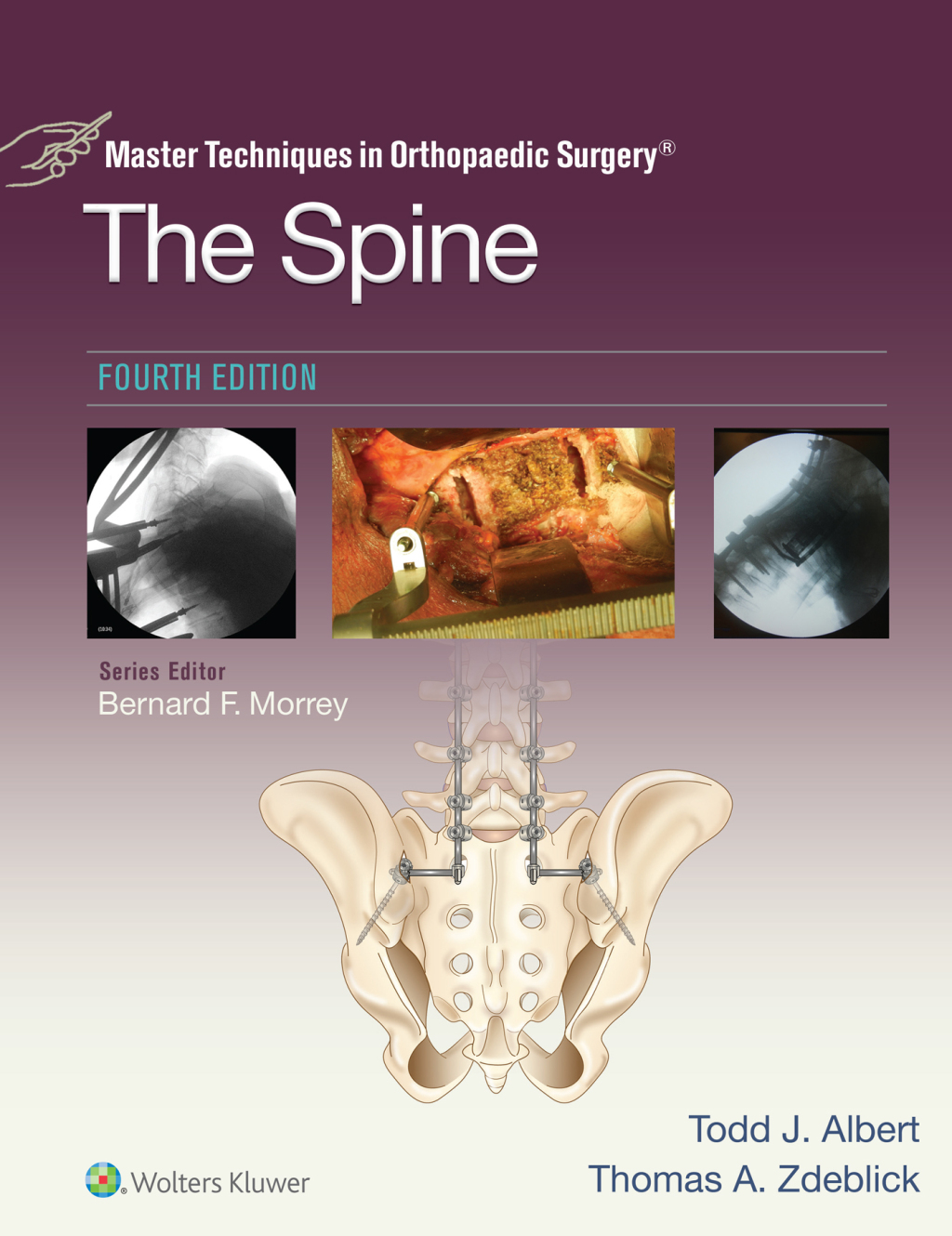 Master Techniques in Orthopaedic Surgery: The Spine 4th Edition â€“ PDF/EPUB Version Downloadable