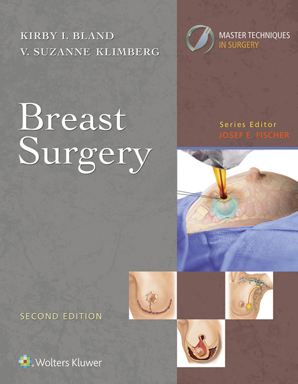 Master Techniques in Surgery: Breast Surgery 2nd Edition â€“ PDF/EPUB Version Downloadable