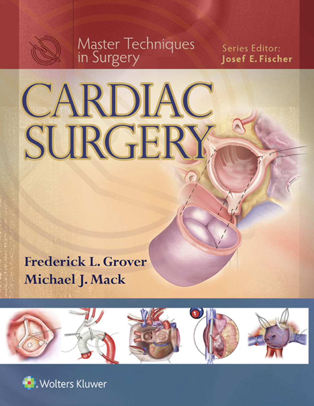 Master Techniques in Surgery: Cardiac Surgery  â€“ PDF/EPUB Version Downloadable