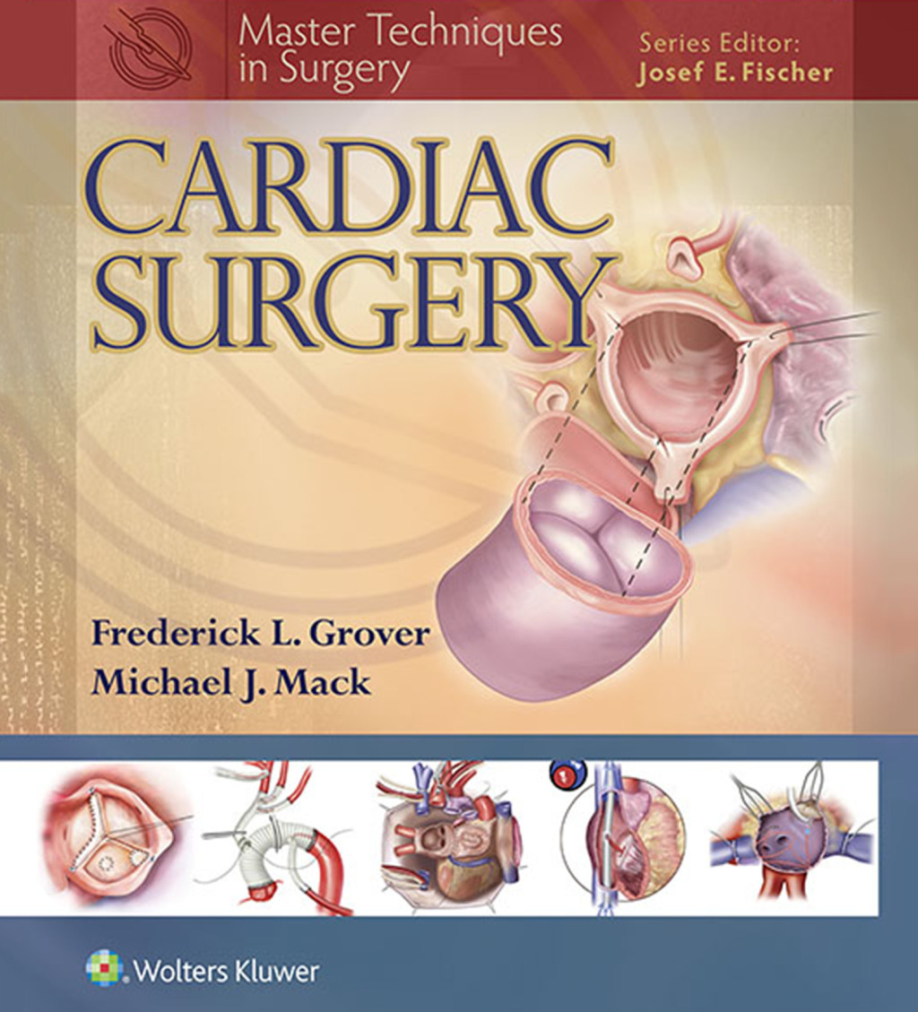 Master Techniques in Surgery: Cardiac Surgery – PDF/EPUB Version Downloadable