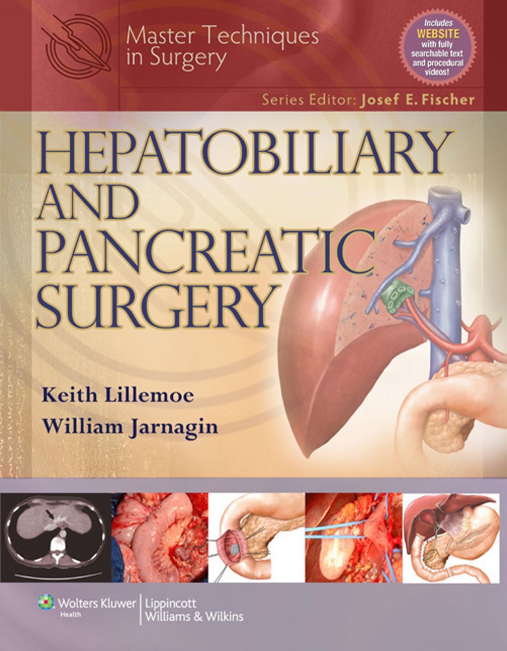 Master Techniques in Surgery: Hepatobiliary and Pancreatic Surgery 1st Edition â€“ PDF/EPUB Version Downloadable