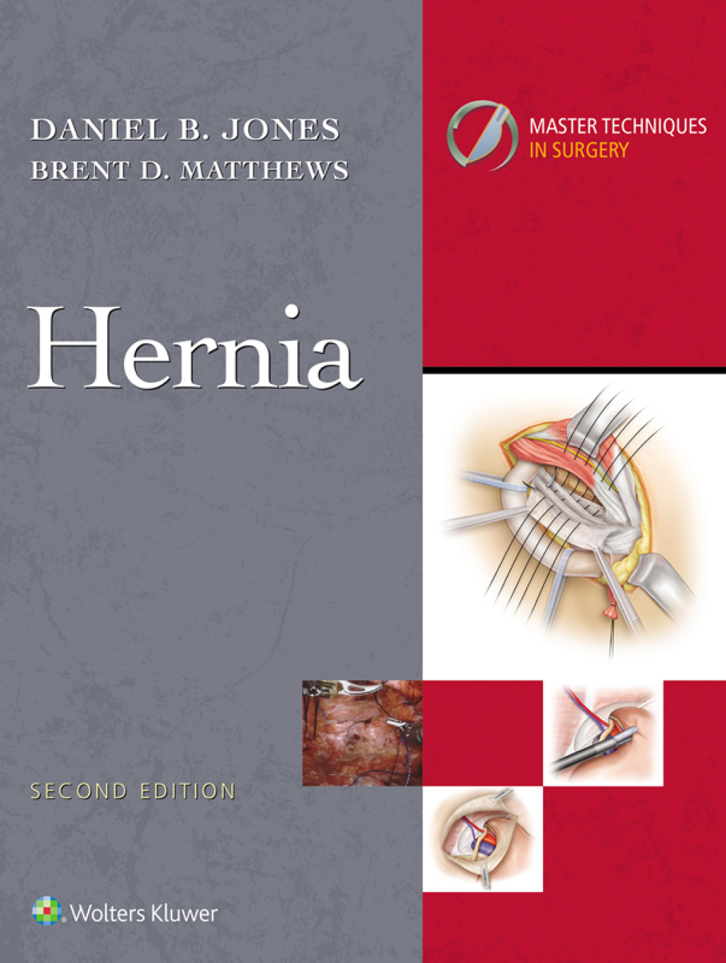 Master Techniques in Surgery: Hernia eBook with Multimedia 2nd Edition â€“ PDF/EPUB Version Downloadable