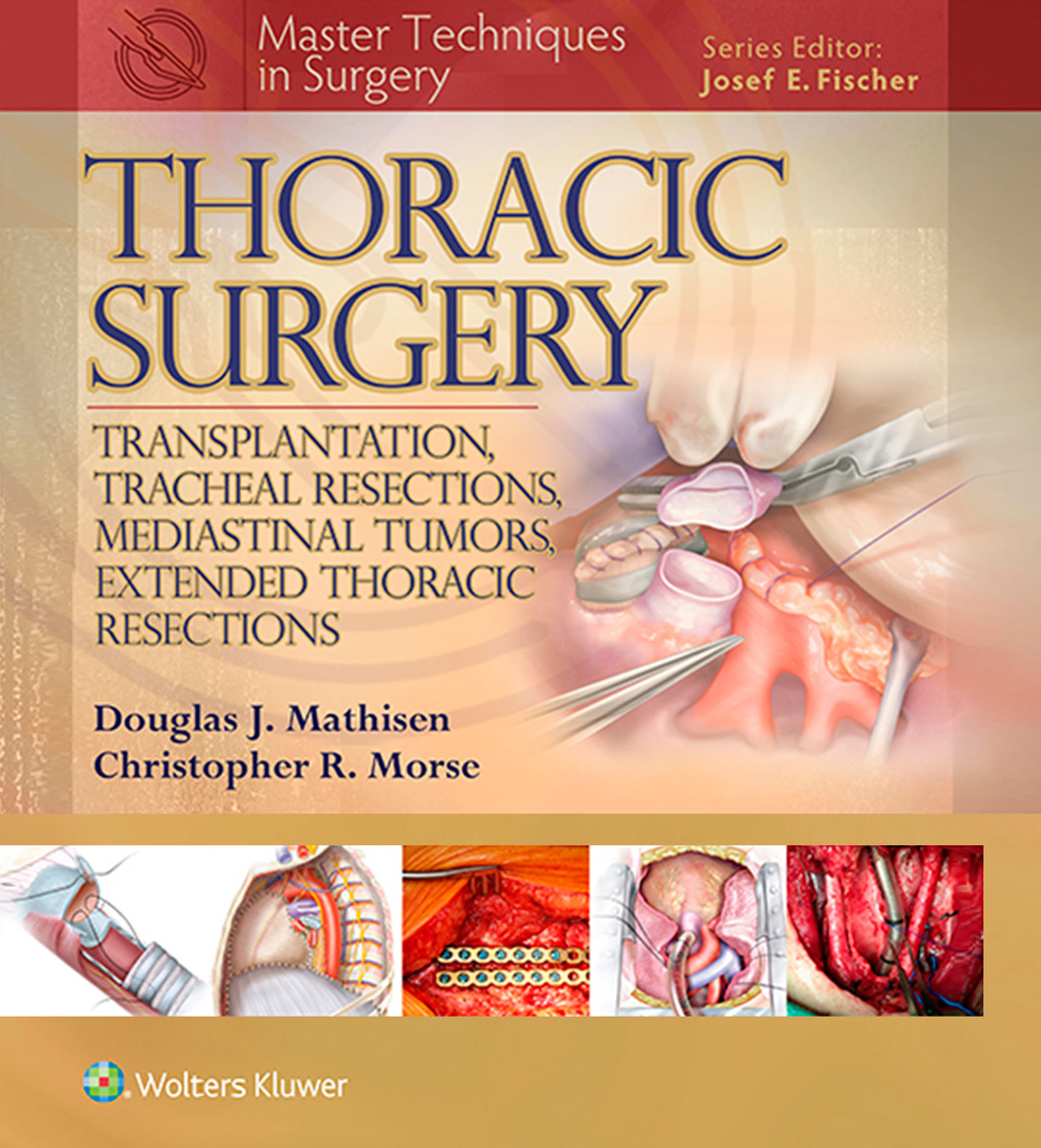 Master Techniques in Surgery: Thoracic Surgery: Transplantation, Tracheal Resections, Mediastinal Tumors, Extended Thoracic Resections  â€“ PDF/EPUB Version Downloadable