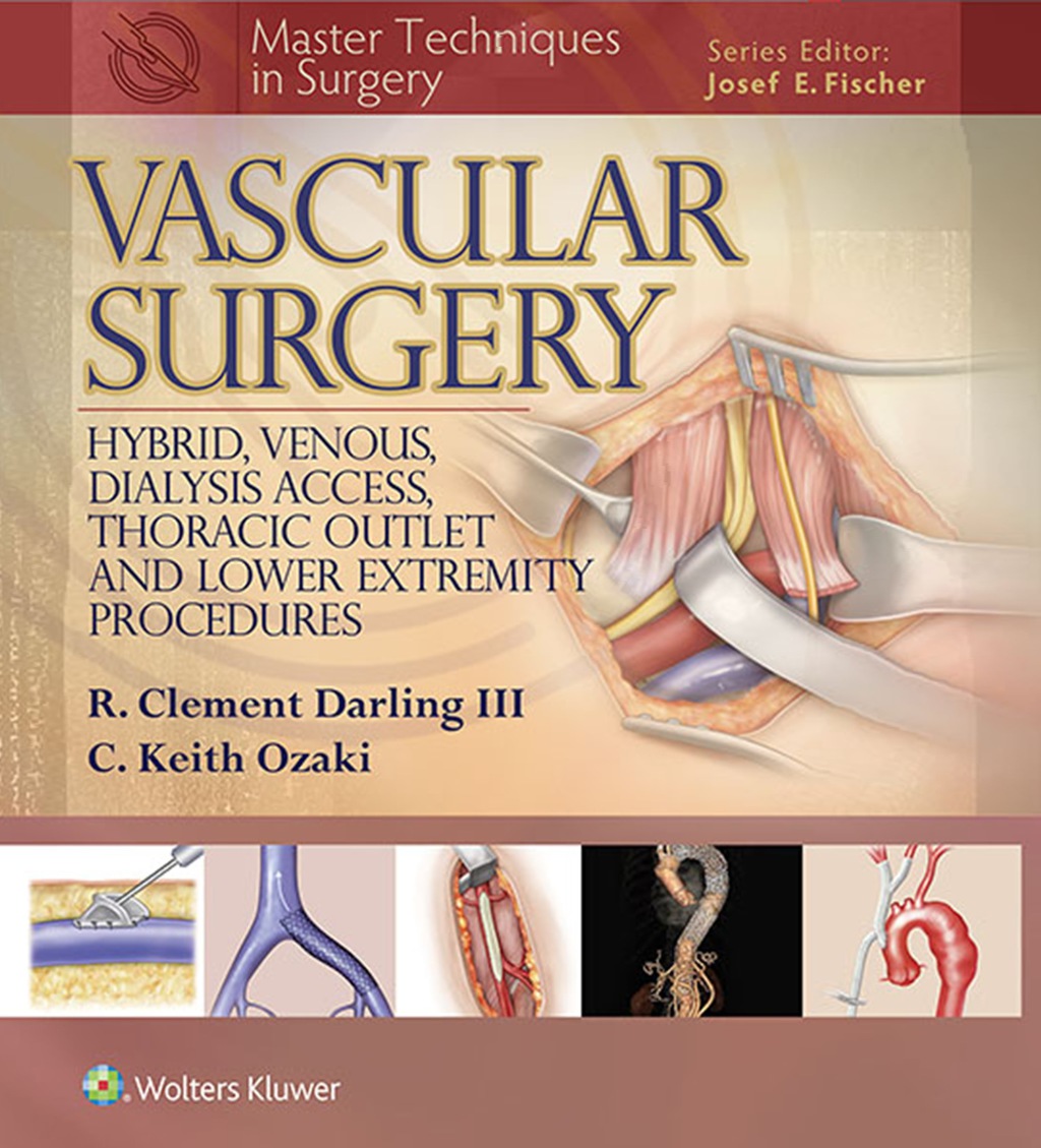 Master Techniques in Surgery: Vascular Surgery: Hybrid, Venous, Dialysis Access, Thoracic Outlet, and Lower Extremity Procedures  â€“ PDF/EPUB Version Downloadable