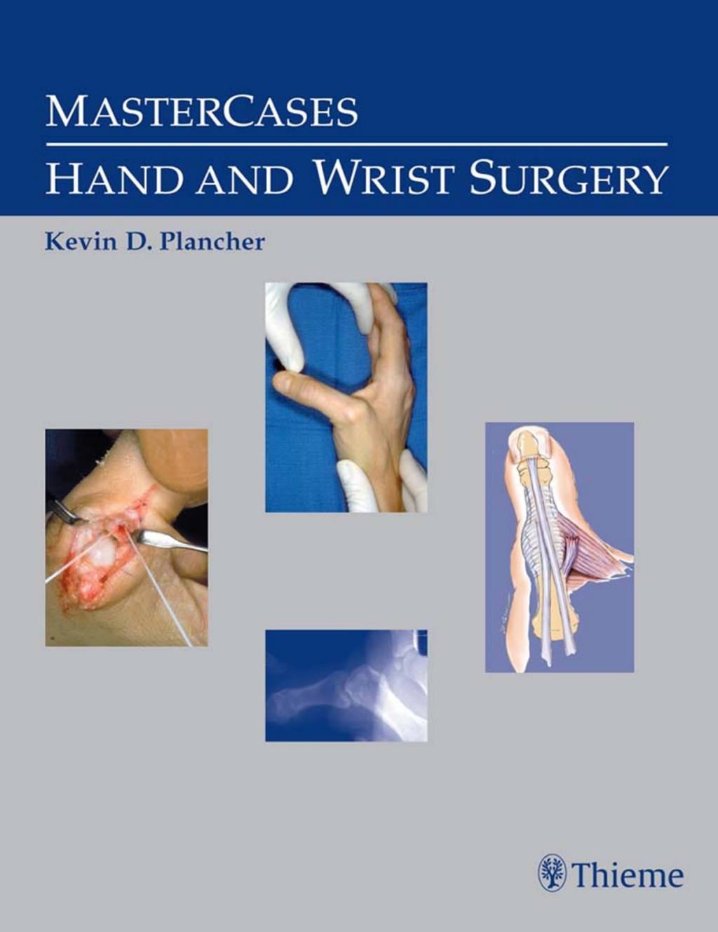 MasterCases in Hand and Wrist Surgery 1st Edition â€“ PDF/EPUB Version Downloadable