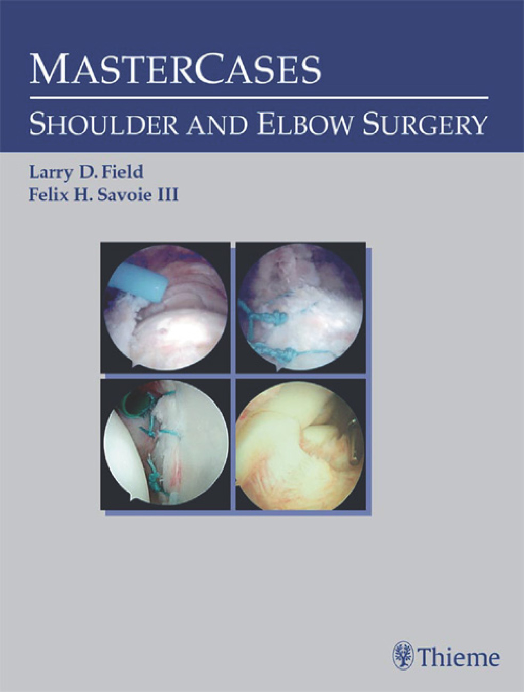 MasterCases in Shoulder and Elbow Surgery 1st Edition – PDF/EPUB Version Downloadable