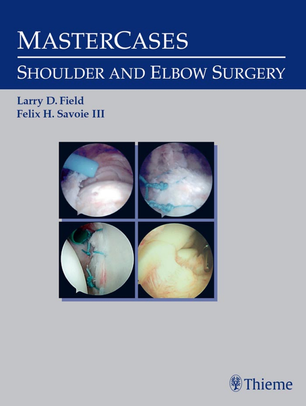 MasterCases in Shoulder and Elbow Surgery 1st Edition â€“ PDF/EPUB Version Downloadable