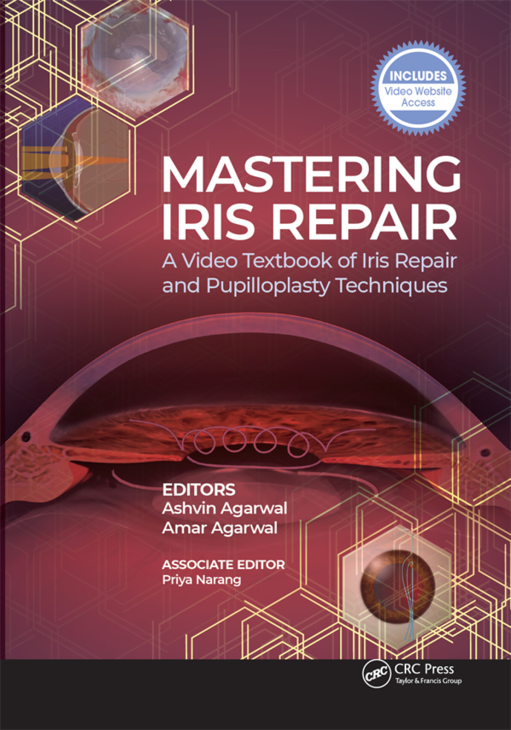 Mastering Iris Repair A Video Textbook of Iris Repair and Pupilloplasty Techniques 1st Edition â€“ PDF/EPUB Version Downloadable