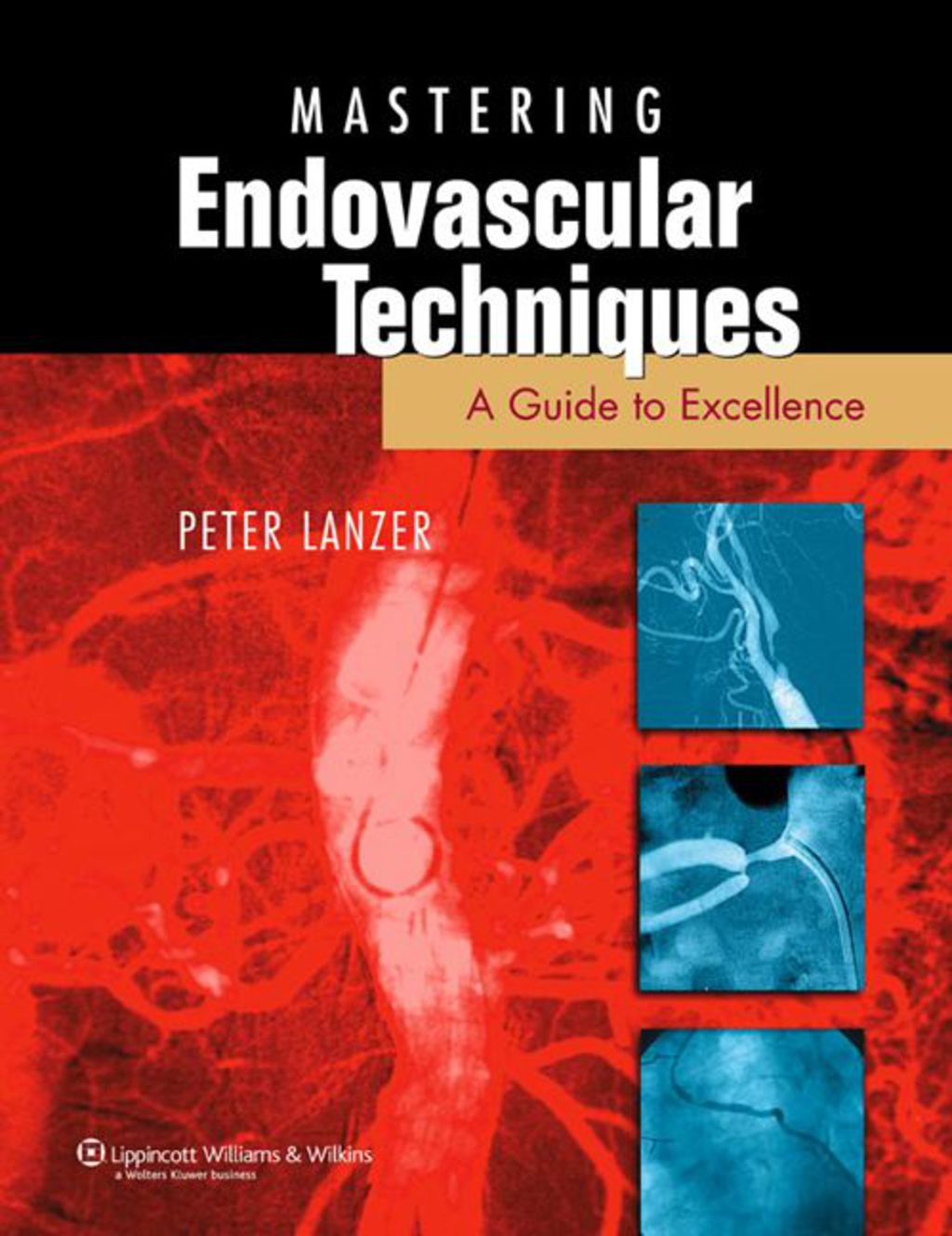 Mastery of Endovascular Interventions 1st Edition â€“ PDF/EPUB Version Downloadable