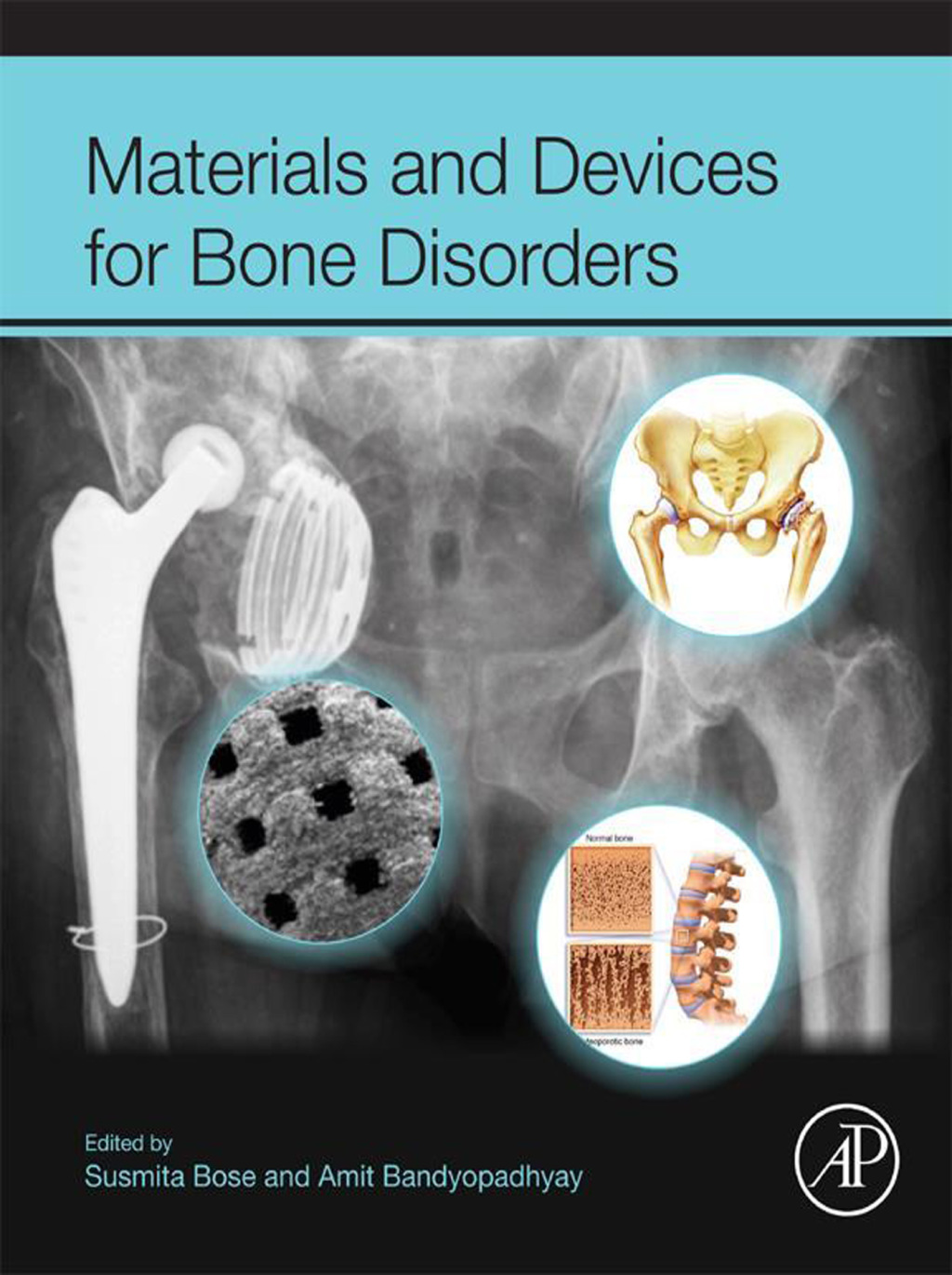 Materials and Devices for Bone Disorders  â€“ PDF/EPUB Version Downloadable