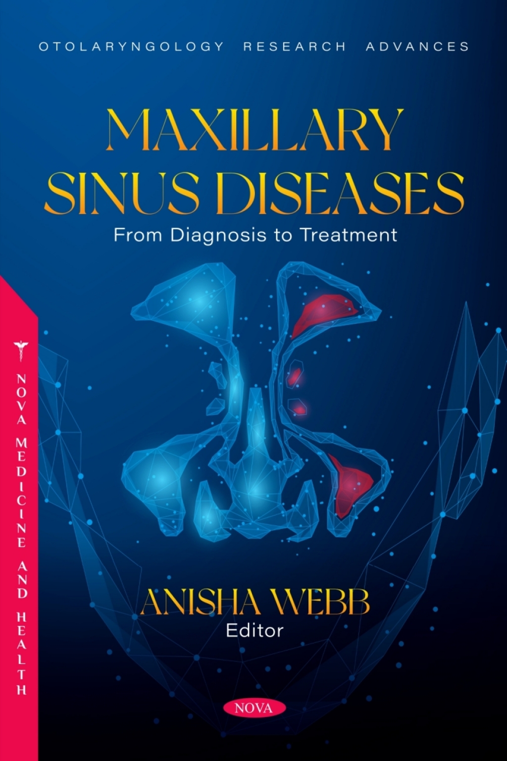 Maxillary Sinus Diseases: From Diagnosis to Treatment  â€“ PDF/EPUB Version Downloadable