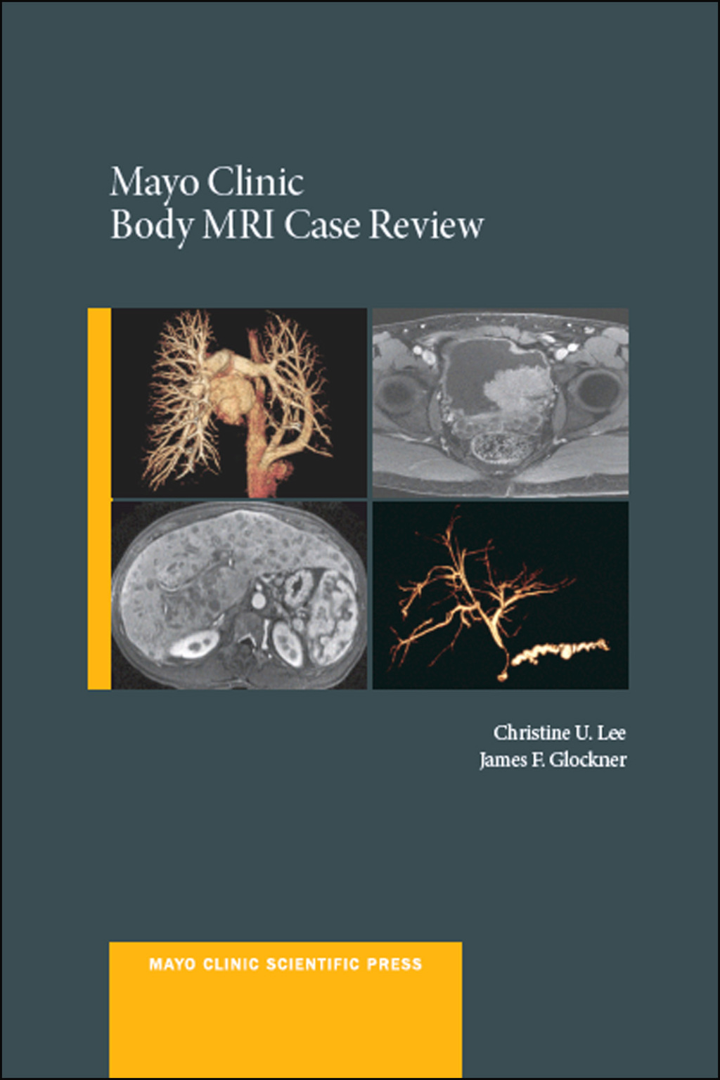 Mayo Clinic Body MRI Case Review  â€“ PDF/EPUB Version Downloadable