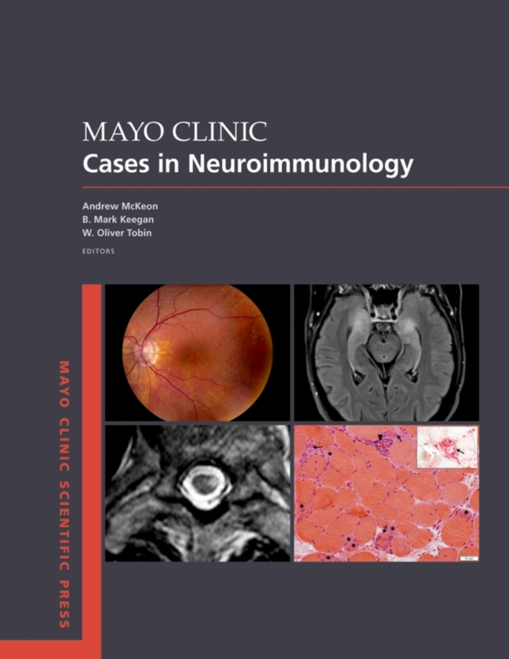 Mayo Clinic Cases in Neuroimmunology  â€“ PDF/EPUB Version Downloadable