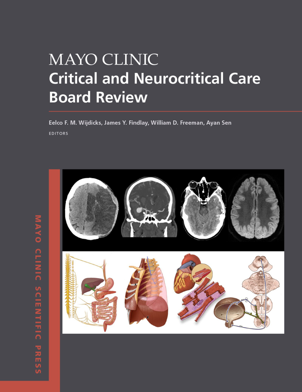 Mayo Clinic Critical and Neurocritical Care Board Review 1st Edition â€“ PDF/EPUB Version Downloadable
